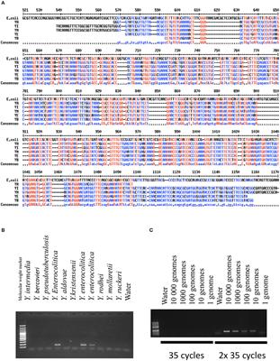 Prevalence of Yersinia Species in the Ileum of Crohn's Disease Patients and Controls